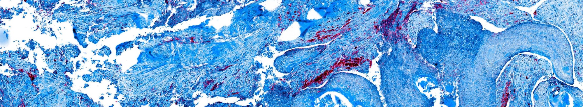Oncology LP image